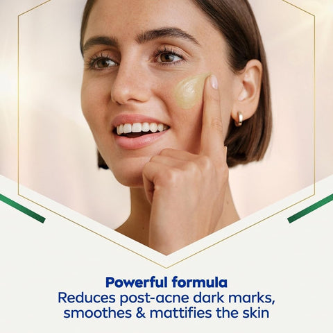 Nivea Luminous 630 Post-Acne Dark Marks Serum 30ml